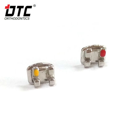 Металлические скобки DTC Bright Series - ключ к успешному ортодонтическому лечению II класса