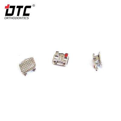 Металлические скобки DTC Bright Series - ключ к успешному ортодонтическому лечению II класса